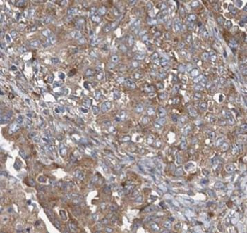 MUC16 Rabbit Polyclonal Antibody