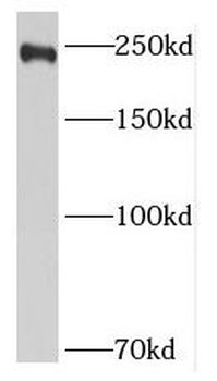 MUC4 Rabbit Polyclonal Antibody