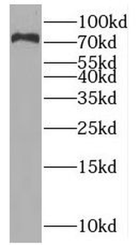 PWWP3A Rabbit Polyclonal Antibody