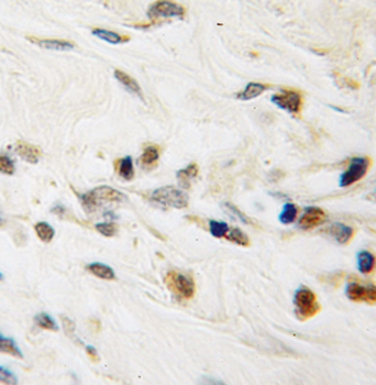 PWWP3A Rabbit Polyclonal Antibody