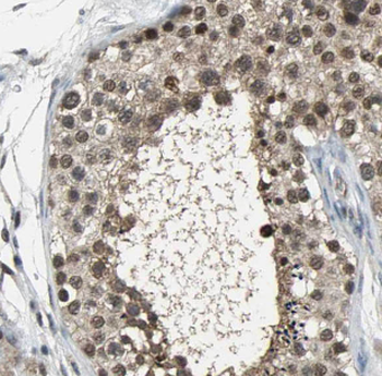 PWWP3B Rabbit Polyclonal Antibody