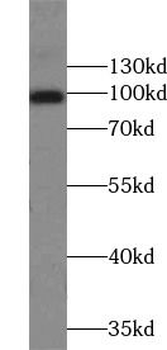 MVP Rabbit Polyclonal Antibody