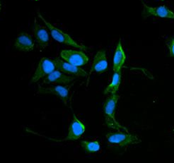 MVP Rabbit Polyclonal Antibody