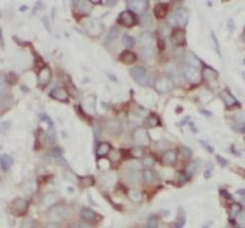 MVP Rabbit Polyclonal Antibody