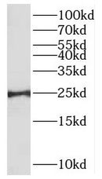 MXD1 Rabbit Polyclonal Antibody