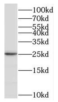 MXD1 Rabbit Polyclonal Antibody
