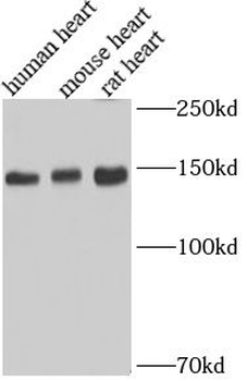 MYBPC3 Rabbit Polyclonal Antibody