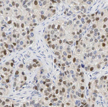 MYEF2 Rabbit Polyclonal Antibody