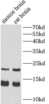 MBP Rabbit Polyclonal Antibody