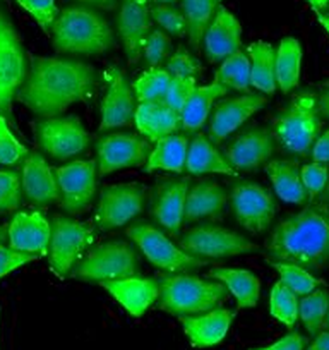 MYH1 Rabbit Polyclonal Antibody
