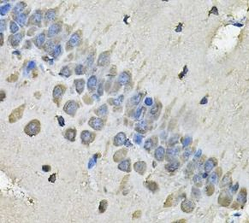 MYH1 Rabbit Polyclonal Antibody