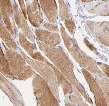 MYH1 Rabbit Polyclonal Antibody