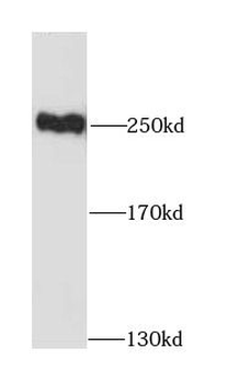 MYH10 Rabbit Polyclonal Antibody