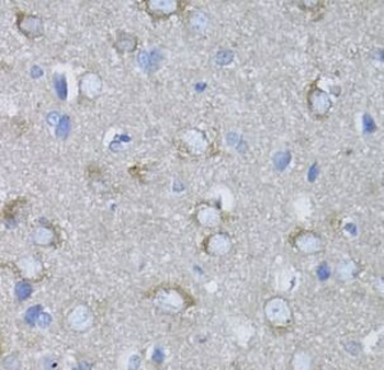 MYH10 Rabbit Polyclonal Antibody