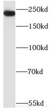MYH3 Rabbit Polyclonal Antibody