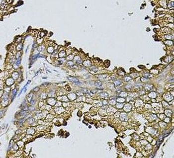 MYL1 Rabbit Polyclonal Antibody