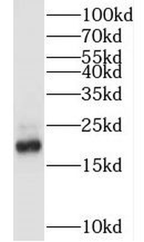 MYL12A Rabbit Polyclonal Antibody