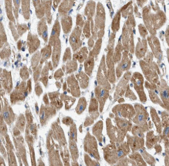 MYL12A Rabbit Polyclonal Antibody