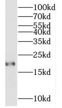 MYL7 Rabbit Polyclonal Antibody