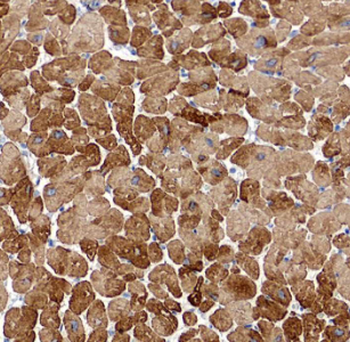 MYL7 Rabbit Polyclonal Antibody