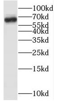 MYLK2 Rabbit Polyclonal Antibody