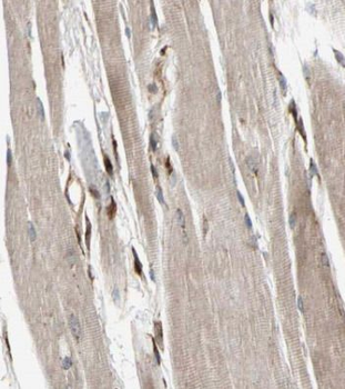 MYL11 Rabbit Polyclonal Antibody