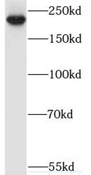 MYO16 Rabbit Polyclonal Antibody