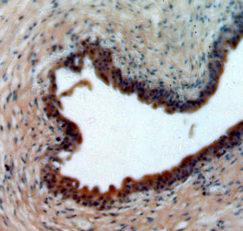 MYO16 Rabbit Polyclonal Antibody