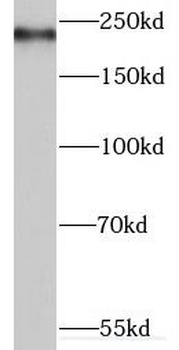 MYO16 Rabbit Polyclonal Antibody