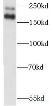 MYO18A Rabbit Polyclonal Antibody