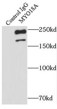 MYO18A Rabbit Polyclonal Antibody