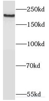 MYO7A Rabbit Polyclonal Antibody