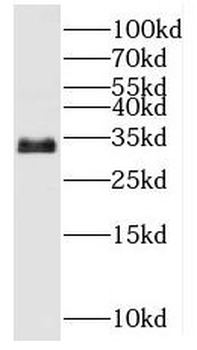 MYOZ2 Rabbit Polyclonal Antibody