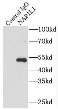 NAP1L1 Rabbit Polyclonal Antibody