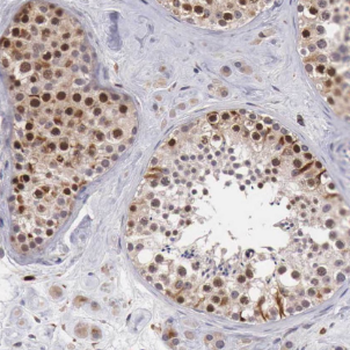 NAP1L1 Rabbit Polyclonal Antibody