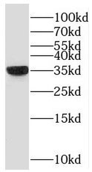 NAPG Rabbit Polyclonal Antibody