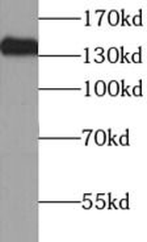 NBR1 Rabbit Polyclonal Antibody