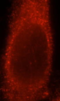NBR1 Rabbit Polyclonal Antibody