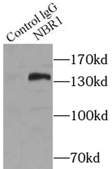 NBR1 Rabbit Polyclonal Antibody