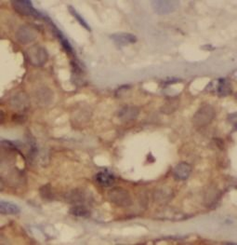 NBR1 Rabbit Polyclonal Antibody