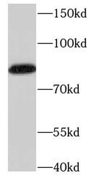 NCBP1 Rabbit Polyclonal Antibody