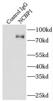NCBP1 Rabbit Polyclonal Antibody