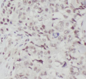 NCBP1 Rabbit Polyclonal Antibody