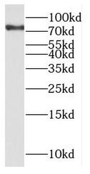 NCKIPSD Rabbit Polyclonal Antibody
