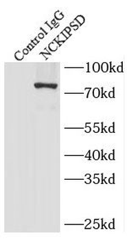 NCKIPSD Rabbit Polyclonal Antibody