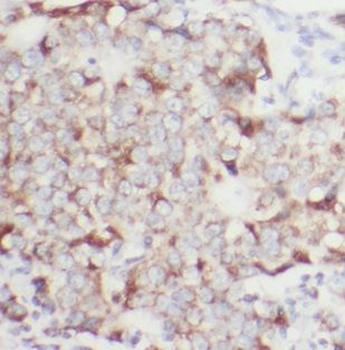 NCKIPSD Rabbit Polyclonal Antibody