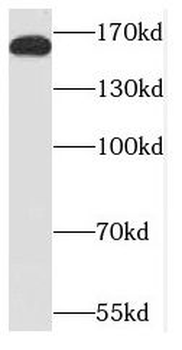 NCOA3 Rabbit Polyclonal Antibody