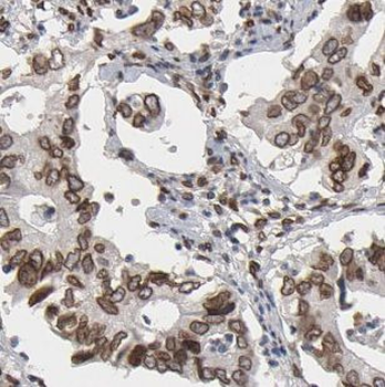 NCOA3 Rabbit Polyclonal Antibody