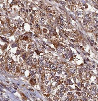 NCOR1 Rabbit Polyclonal Antibody