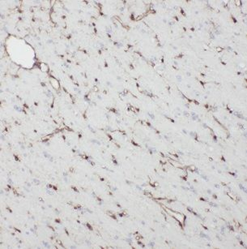 NDC80 Rabbit Polyclonal Antibody